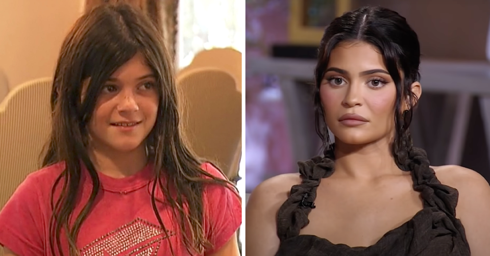 Kylie Jenner before and after