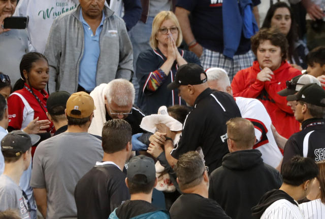 toddler hit by foul ball face