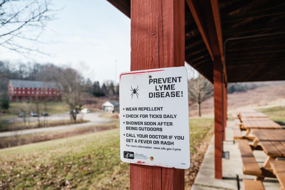 A sign warning people about Lyme disease is displayed at the Norma Johnson Center in Dover Township.