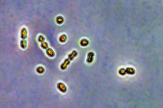 Imagen de archivo de una muestra de bacteria 'Streptococcus agalactiae'.