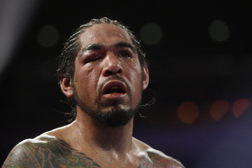 Antonio Margarito, of Mexico, looks on during the eighth round of an WBA World Junior Middleweight Championship boxing match against Miguel Cotto, of Puerto Rico, Sunday, Dec. 4, 2011 in New York. Cotto defeated Margarito with a TKO decision amid confusion in the corner before they came out for the 10th round. (AP Photo/Frank Franklin II)