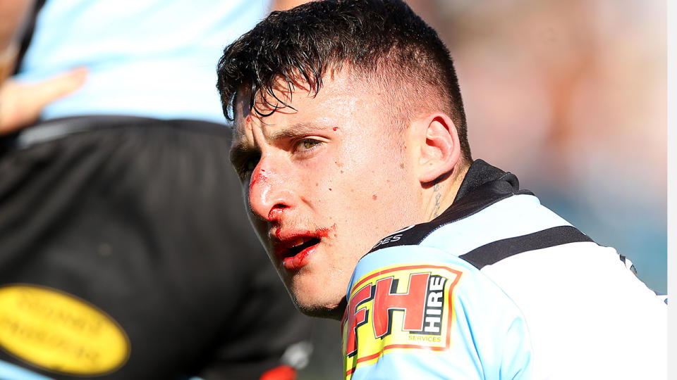 Bronson Xerri is pictured with a bloodied nose during an NRL match.