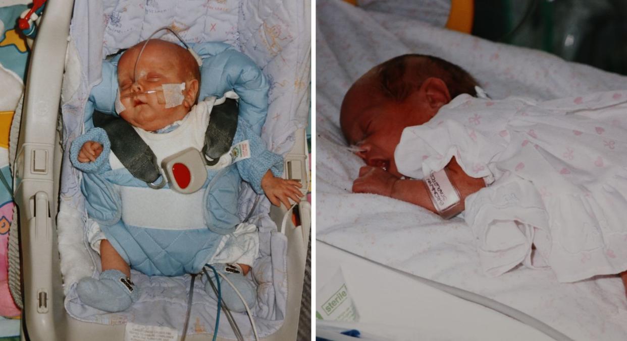 Jack and Bronwyn were both born prematurely. (Bronwyn Tacey/SWNS)