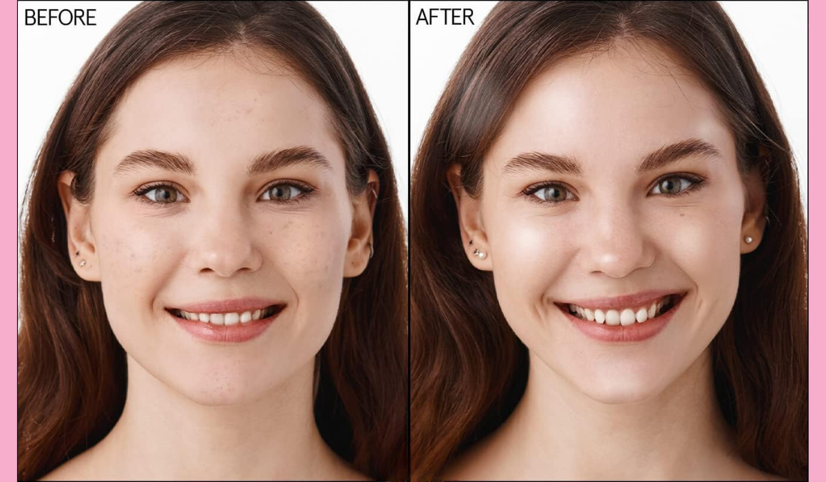 Before and After images - Before: a woman with some dark spots on her cheeks. After: The same woman now has clearer skin.