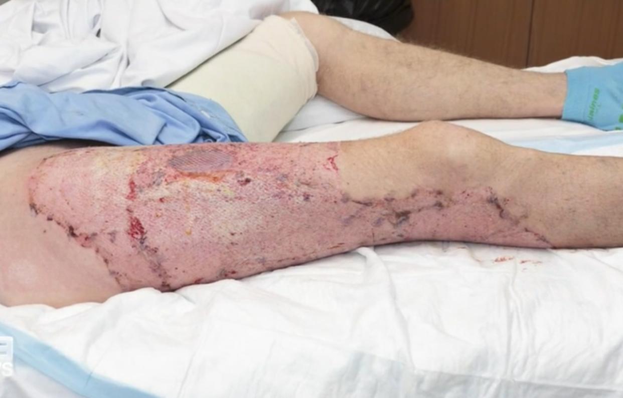 The 40-year-old man has years of treatment ahead. Picture: 9 News