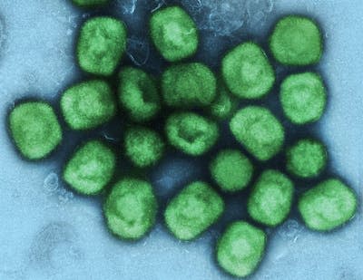 Virus de la viruela símica. <a href="https://commons.wikimedia.org/wiki/File:Colorized_transmission_electron_micrograph_of_monkeypox_virus_particles_(green).jpg" rel="nofollow noopener" target="_blank" data-ylk="slk:Wikimedia Commons / NIAID;elm:context_link;itc:0;sec:content-canvas" class="link ">Wikimedia Commons / NIAID</a>, <a href="http://creativecommons.org/licenses/by/4.0/" rel="nofollow noopener" target="_blank" data-ylk="slk:CC BY;elm:context_link;itc:0;sec:content-canvas" class="link ">CC BY</a>