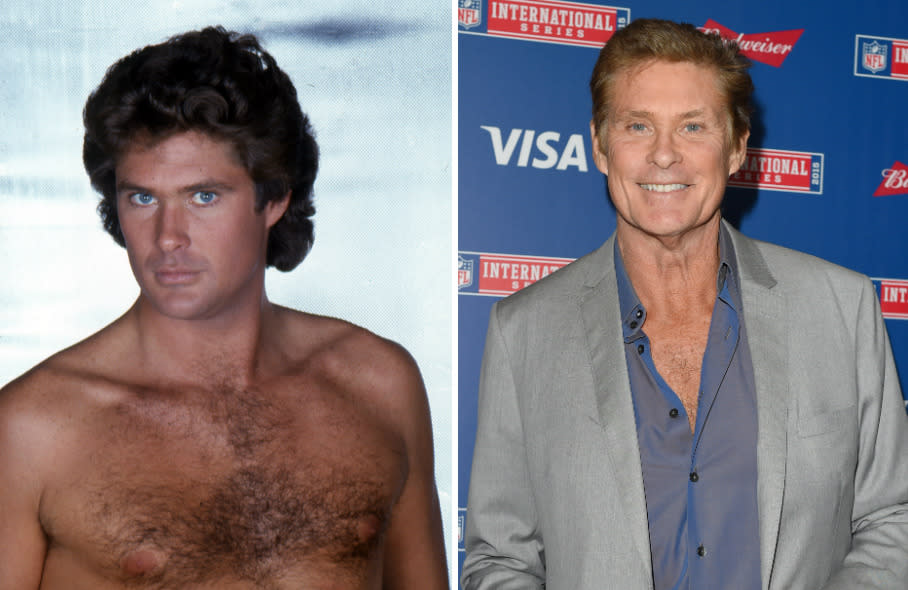 La cara tan estirada de David Hasselhoff deja a las claras su abuso del botox y el estiramiento facial. Pero además, el mítico Mitch Buchannon de ‘Los vigilantes de la playa’ también se ha retocado el mentón y los párpados. (Foto de Donaldson Collection/Michael Ochs Archives/Karwai Tang/Getty Images).