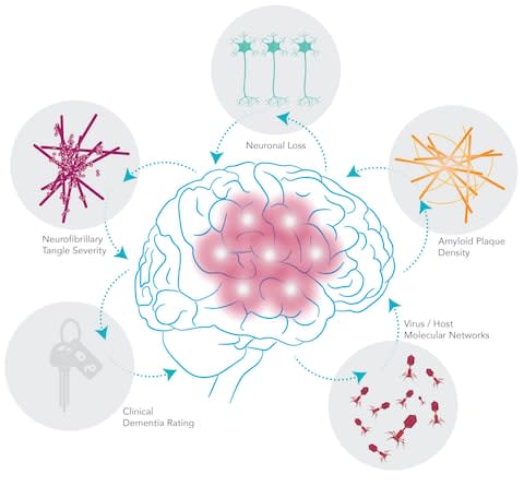 How herpes in the brain could trigger Alzheimer's 