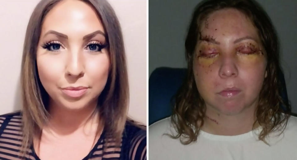 Woman shown before and after brutal hotel attack where a man allegedly strangled and bashed her.