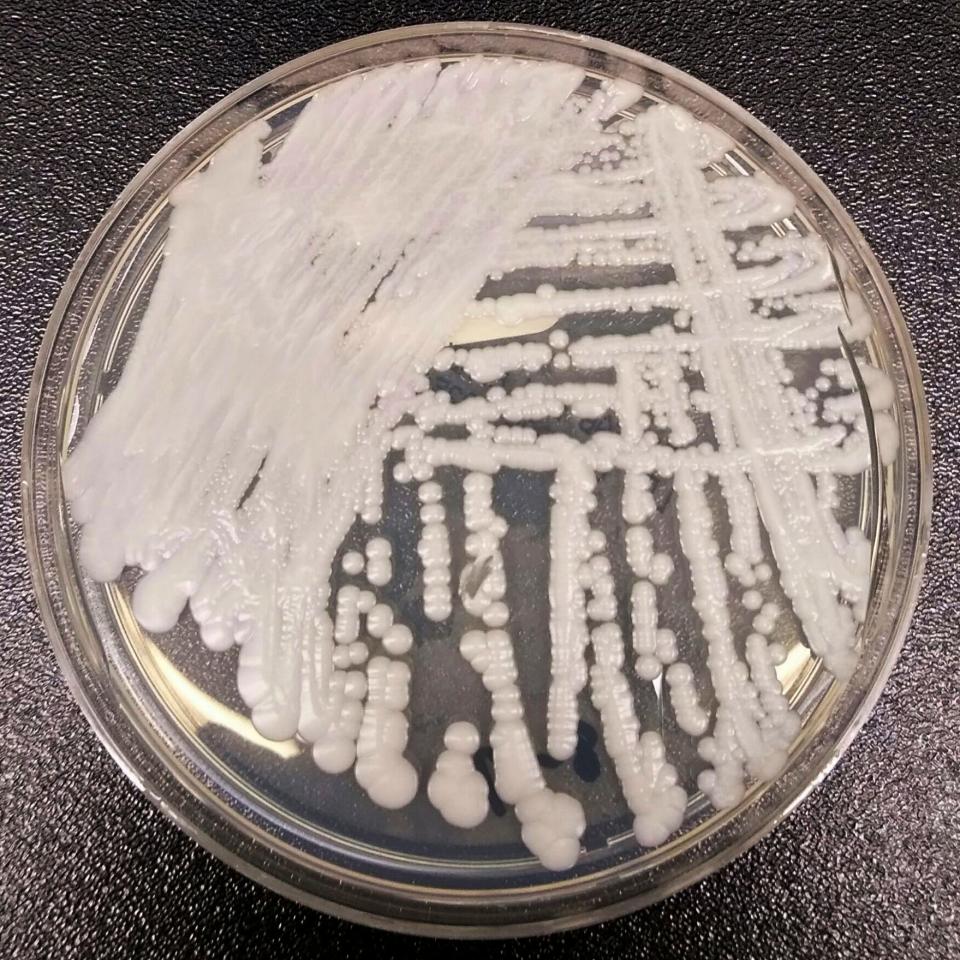 This photo made available by the Centers for Disease Control and Prevention shows a strain of Candida auris cultured in a petri dish at a CDC laboratory.