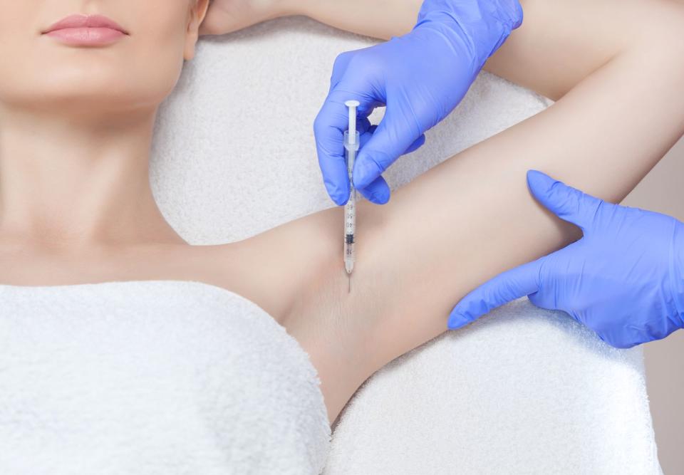 Wer zu extremeren und auch teureren Mitteln greifen will, kann sich fürs Nervengift entscheiden. Mit Botox zu unterspritzen bedeutet, dass die Schweißdrüsen gelähmt werden und für eine gewisse Zeit ihre Aktivität einstellen. Aber der Effekt hält nicht ewig, die Schweißproduktion wird mit der Zeit zurückkommen und Folgeanwendungen werden nötig. (Bild: iStock / dimid_86)