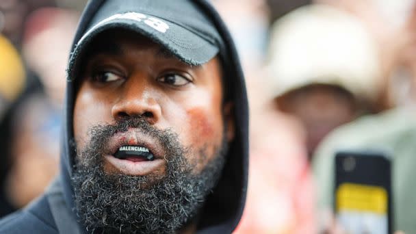 PHOTO: Kanye West aka Ye is seen wearing a Balenciaga boxing mouth guard, outside Givenchy, during Paris Fashion Week on October 2, 2022, in Paris, France. (Edward Berthelot/GC Images via Getty Images)