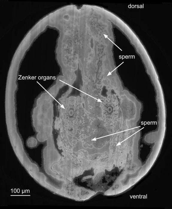 ,A cross section of a male <i>Heterocypris collaris</i>, showing Zenker organs, which act as sperm pumps, as well as sperm stored in the seminal vesicle and ducts.