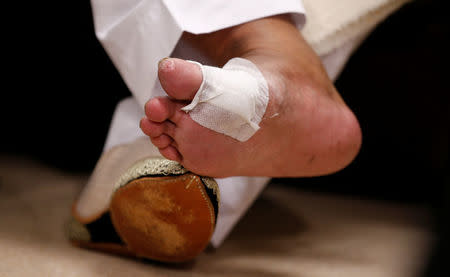 Founder of Pakistan's MQM party, Altaf Hussain, shows off his injured foot during an interview at the party's offices in London, Britain October 30, 2016. REUTERS/Peter Nicholls