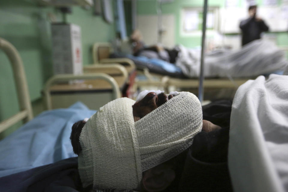 Injured men recover at hospital after a suicide attack in Kabul, Afghanistan, Wednesday, March 1, 2017. A pair of suicide bombings, both claimed by the Taliban, struck the Afghan capital, an Afghan official said. (AP Photo/Rahmat Gul)