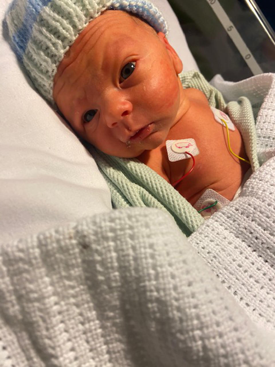 Baby Elliot has been described by his parents as a little fighter. (PA Real Life/Collect) 
