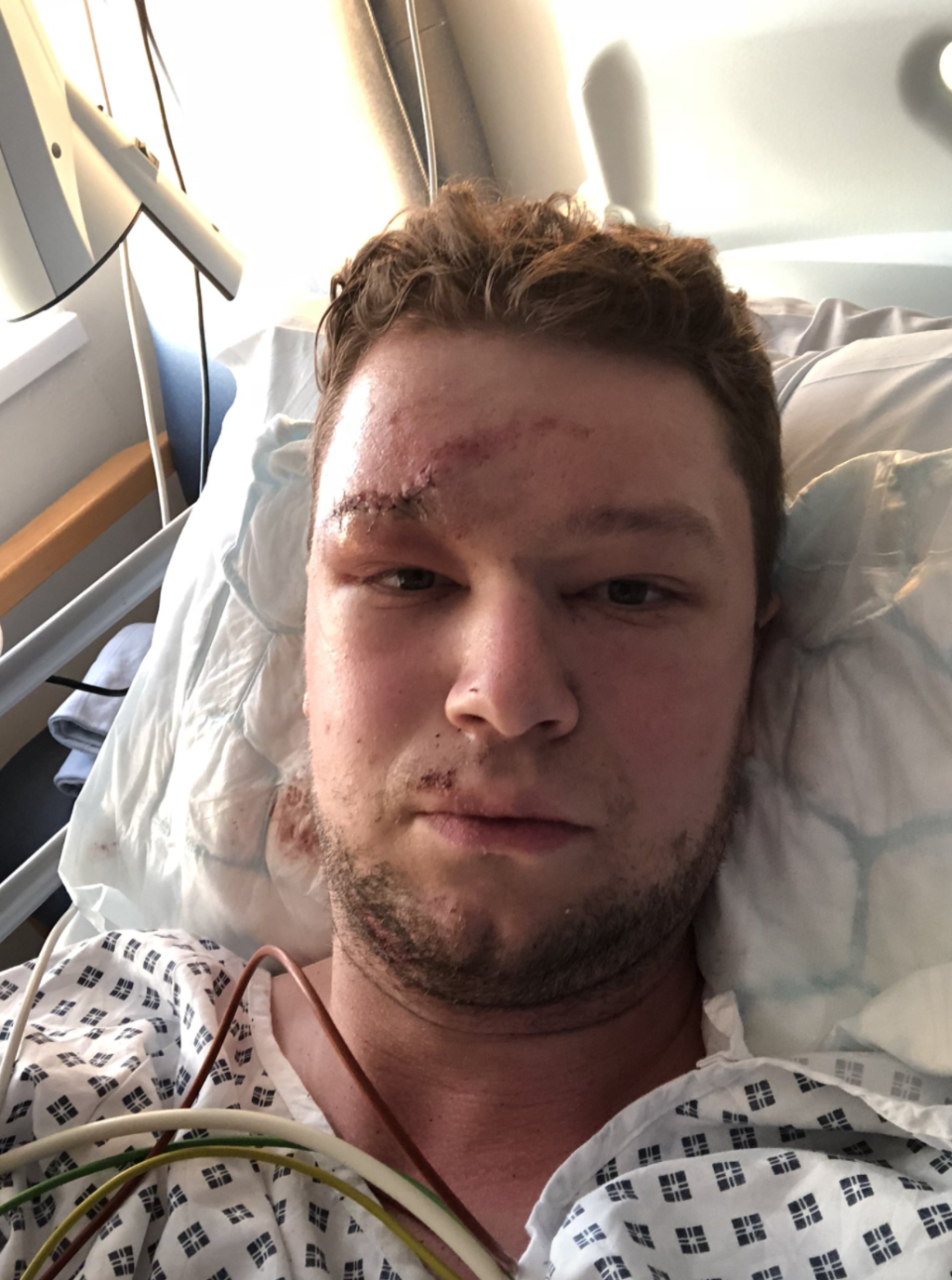 Sgt Dorman suffered severe injuries in the 2018 incident.