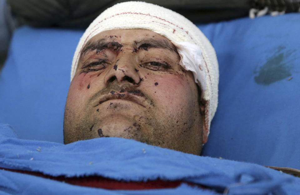 A wounded man lies on a bed in a hospital in Kabul, Afghanistan, Monday, Jan. 14, 2019. Afghan officials say multiple people were killed when a suicide bomber detonated a vehicle full of explosive in the capital Kabul on Monday. (AP Photo/Massoud Hossaini)