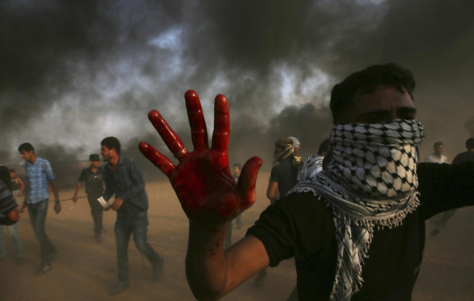 A protester shows his bloody hand while helping a wounded youth as others burn tires near the fence of the Gaza Strip border with Israel east of Khan Younis, southern Gaza Strip, Friday, Oct. 19, 2018. (AP Photo/Adel Hana)