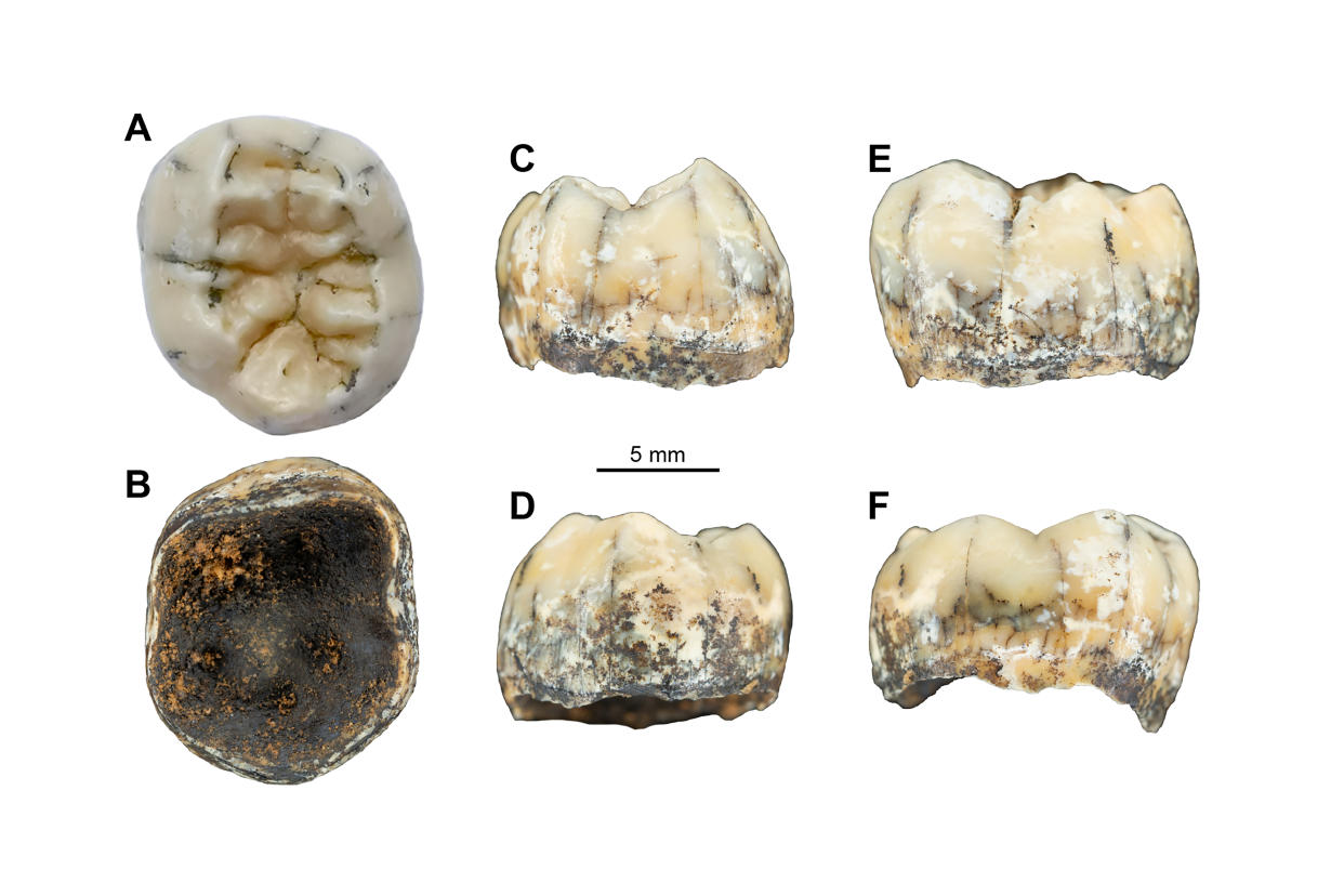 Una fotografía sin fecha proporcionada por F. Demeter muestra un diente antiguo de una niña en las vistas (a) oclusal, (b) inferior, (c) mesial, (d) distal, (e) bucal y (f) lingual. (F. Demeter vía The New York Times)
