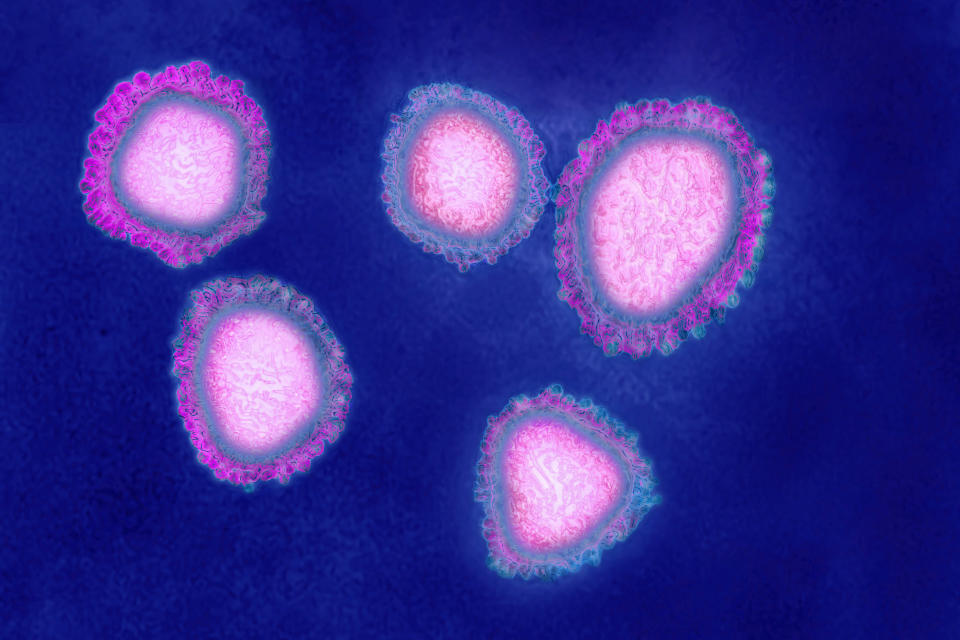 The human coronavirus causes respiratory infections (colds), and gastroenteritis. Image made from a transmission electron microscopy view. Approximate viral diameter: 80 to 160 nm. (Photo by: Cavallini James/BSIP/Universal Images Group via Getty Images)