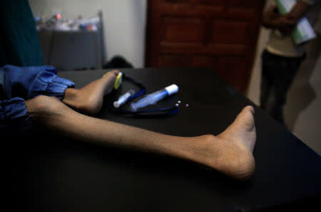 The leg of malnourished Ghazi Ahmad, 10, is pictured as he lies on a stretcher at a hospital in Taiz, Yemen November 3, 2018. Picture taken November 3, 2018. REUTERS/Anees Mahyoub