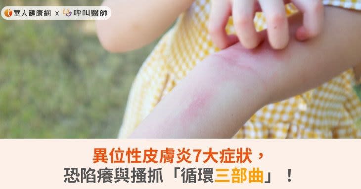 異位性皮膚炎揪7大症狀，恐陷癢與搔抓「循環三部曲」！