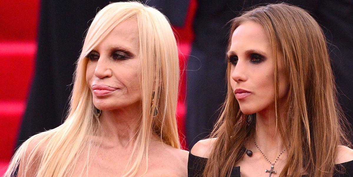 donatella versace - a before and after  Celebrity plastic surgery, Donatella  versace plastic surgery, Plastic surgery