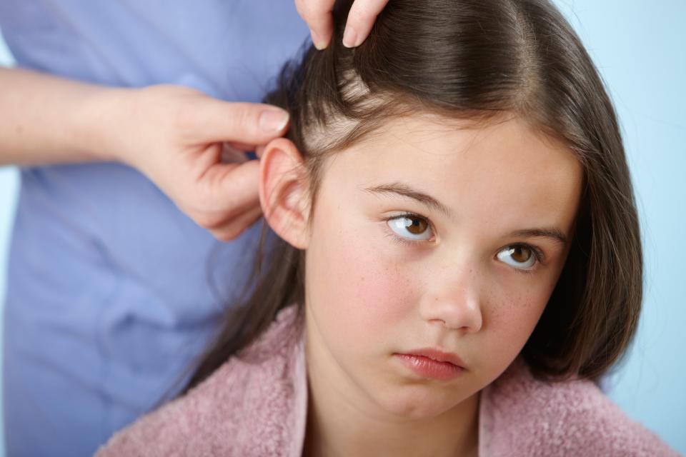 What exactly are lice—and how do you typically get rid of them?