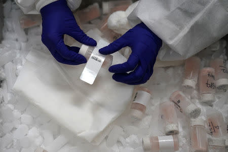 A worker attaches a label on a container that contains a part of a human brain slice at a brain bank in the Bronx borough of New York City, New York, U.S. June 28, 2017. REUTERS/Carlo Allegri