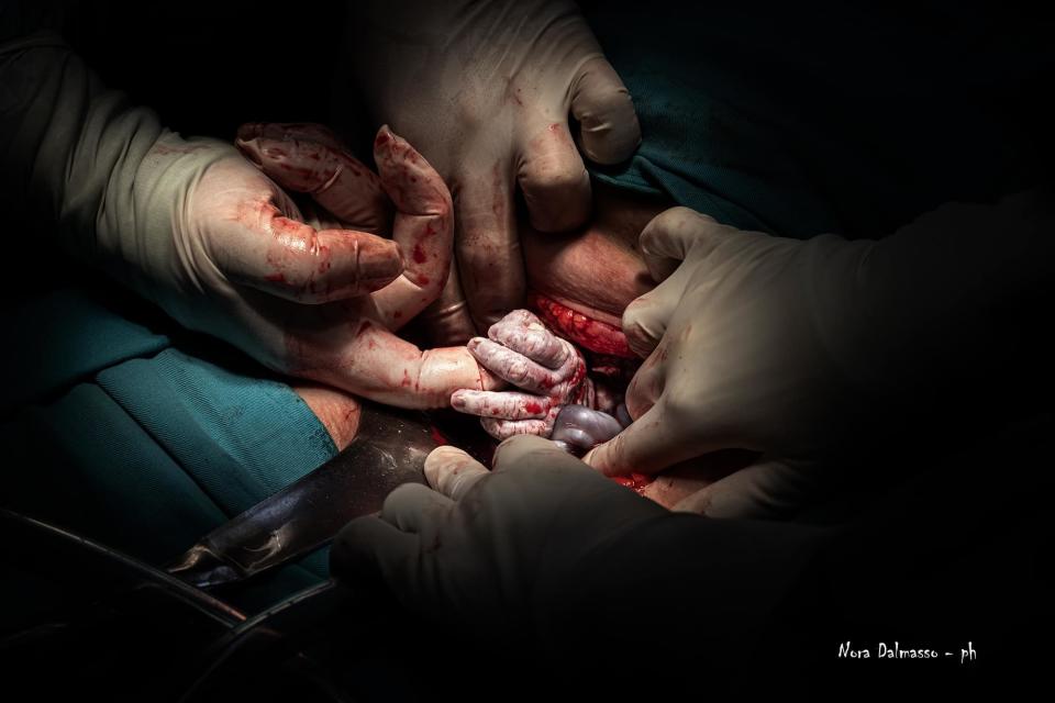 Medical team performing a newborn delivery with focus on the baby being held by gloved hands