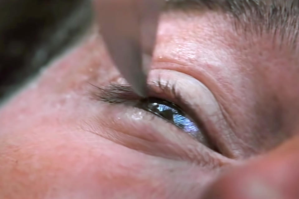 Tom Cruise's Knife to the Eye in Mission: Impossible II