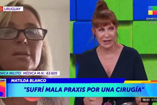 Matilda Blanco y una fallida operación estética: “Quedé con daño