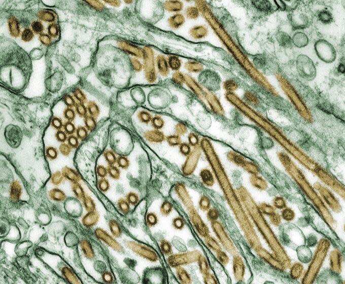 A transmission electron microscope (TEM) imageof Avian Influenza A H5N1 virus particles (seen in gold) grown in Madrin-Darby Canine Kidney (MDCK) epithelial cells (seen in green). CDC Public Health Image Library, Image 1841