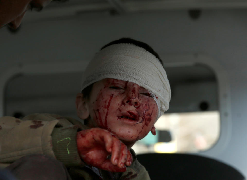 <p>An injured boy sits in an ambulance after a blast in Kabul, Afghanistan, Jan. 27, 2018. (Photo: Mohammad Ismail/Reuters) </p>