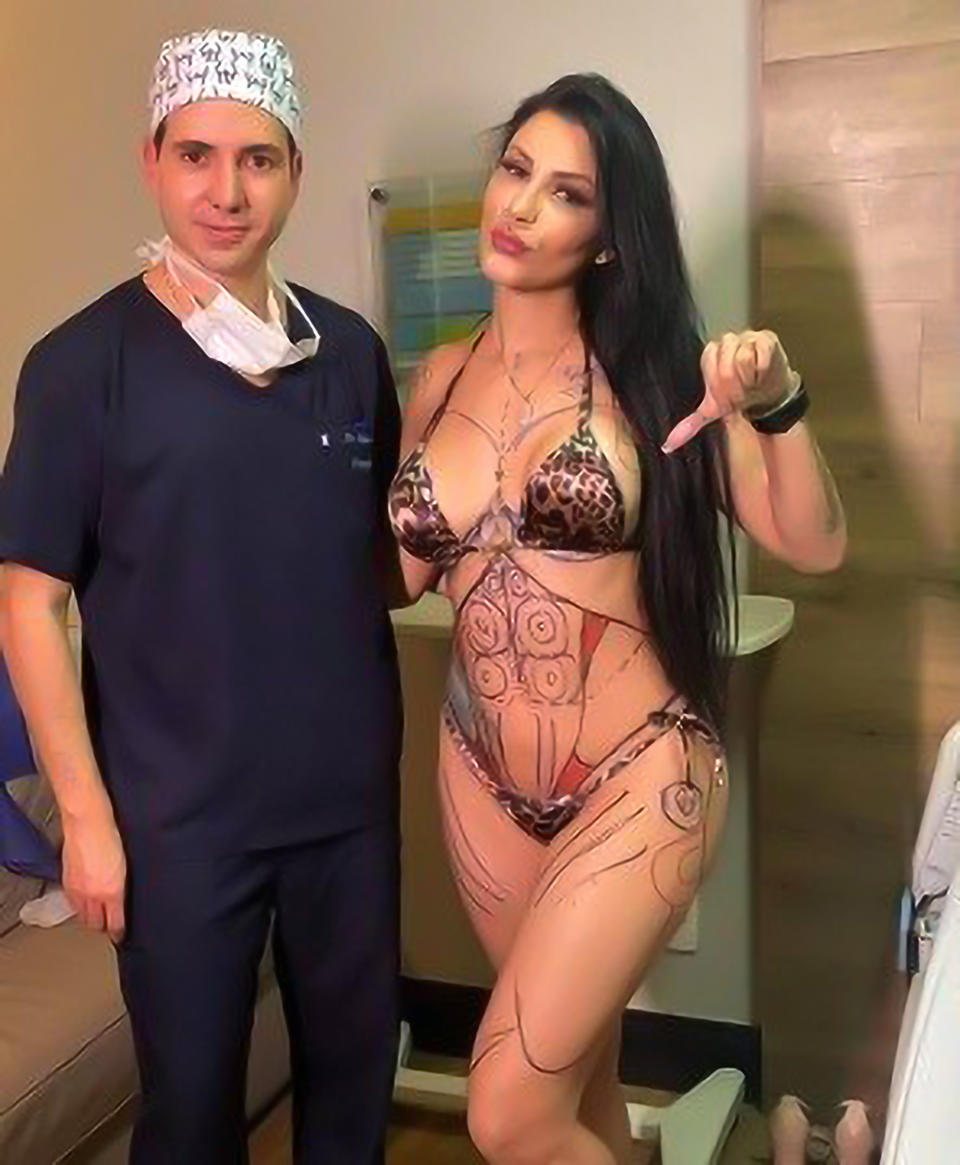 Jenny Miranda and a doctor with her body mapped out for surgery