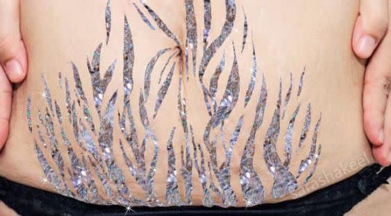 More and more women are embracing their stretch marks. Photo: Instagram/sarashakeel