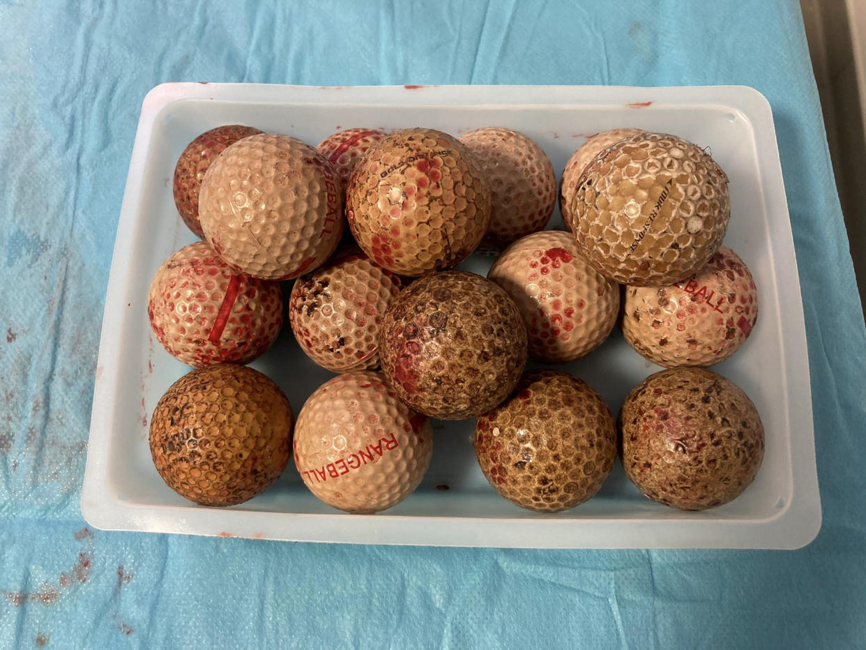 In total 16 golf balls were removed from Ben, (SWNS)