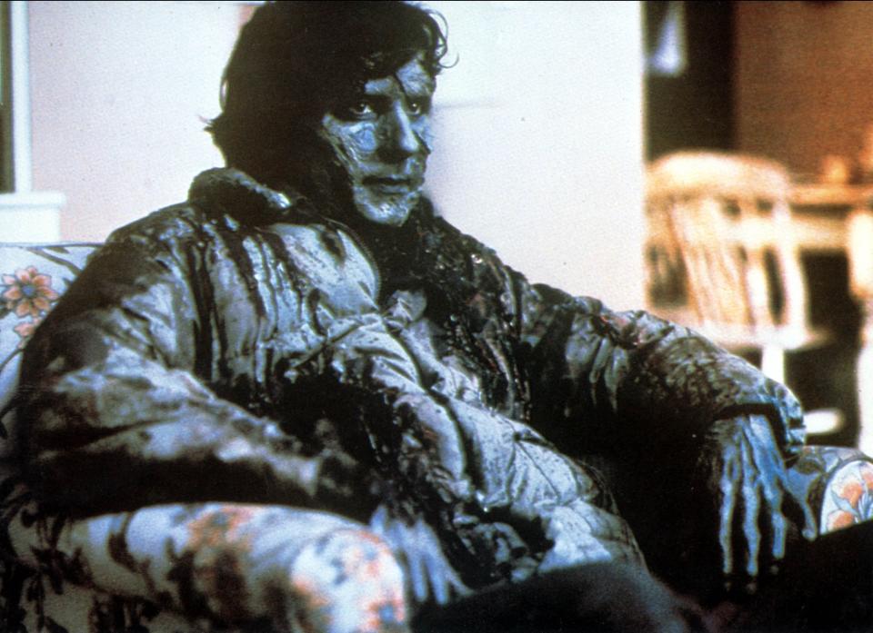 Griffin Dunne in <i>An American Werewolf in London</i>. (Photo: Mary Evans/Ronald Grant/Everett Collection)