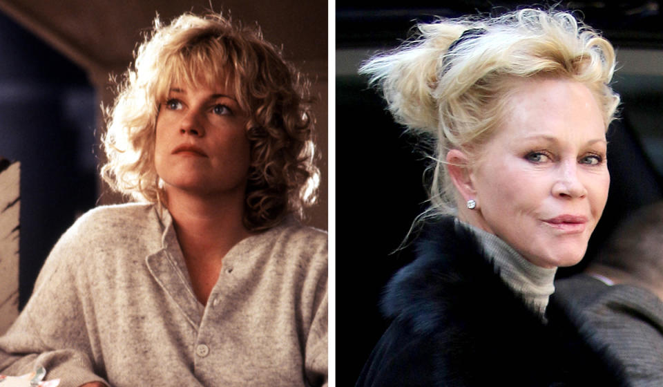 Melanie Griffith: Mel’s unnecessary battle with the results of Father Time is fairly well-documented. Unfortunately, it means that the scrappy sensuousness of her previous screen incarnation is all but gone forever.