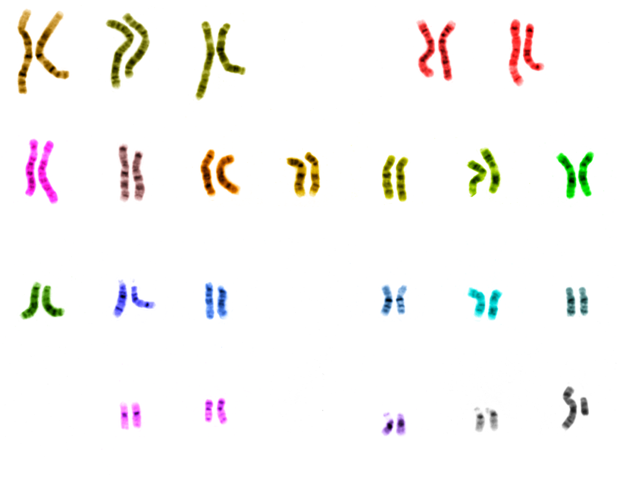 <span class="caption">A complete human genome, seen here in pairs of chromosomes, offers a wealth of information, but it is hard connect genetics to traits or disease.</span> <span class="attribution"><a class="link " href="https://commons.wikimedia.org/wiki/File:UCSC_human_chromosome_colours.png#/media/File:UCSC_human_chromosome_colours.png" rel="nofollow noopener" target="_blank" data-ylk="slk:HYanWong/Wikimedia Comons;elm:context_link;itc:0;sec:content-canvas">HYanWong/Wikimedia Comons</a></span>