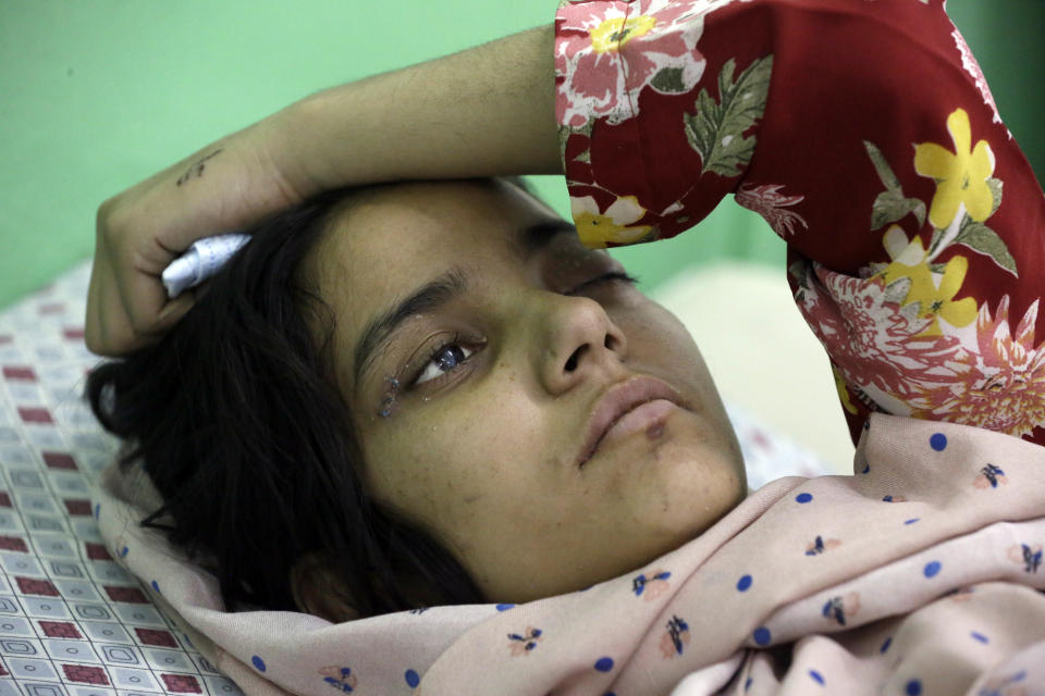 An Afghan girl receives medical care at the International Committee of the Red Cross (ICRC) physical rehabilitation center after being injured in fighting between the Taliban and Afghan security personnel, in Kabul, Afghanistan, Tuesday, Aug. 10, 2021. The International Committee of the Red Cross said Tuesday that its staff has treated more than 4,000 Afghans this month in their 15 facilities across the country, including in Helmand and Kandahar, where Afghan and U.S. airstrikes are trying to rein in the Taliban onslaught. (AP Photo/Mariam Zuhaib)