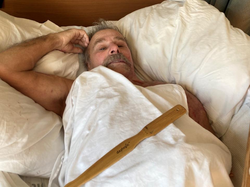 Paul Roberts recovering from his electric shock and burn wounds at Hackensack Meridian Nursing & Rehabilitation in Shrewsbury.
