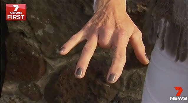 Scott lost a finger due to one of Murphy's attacks. Source: 7 News