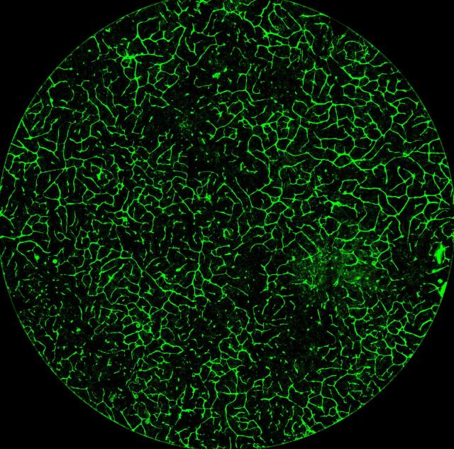 <span class="caption">A cross section of lab-grown human liver tissue. The green shows the network of blood vessels.</span> <span class="attribution"><span class="source">Velazquez et al. Cell Systems </span>, <a class="link " href="http://creativecommons.org/licenses/by-sa/4.0/" rel="nofollow noopener" target="_blank" data-ylk="slk:CC BY-SA;elm:context_link;itc:0">CC BY-SA</a></span>