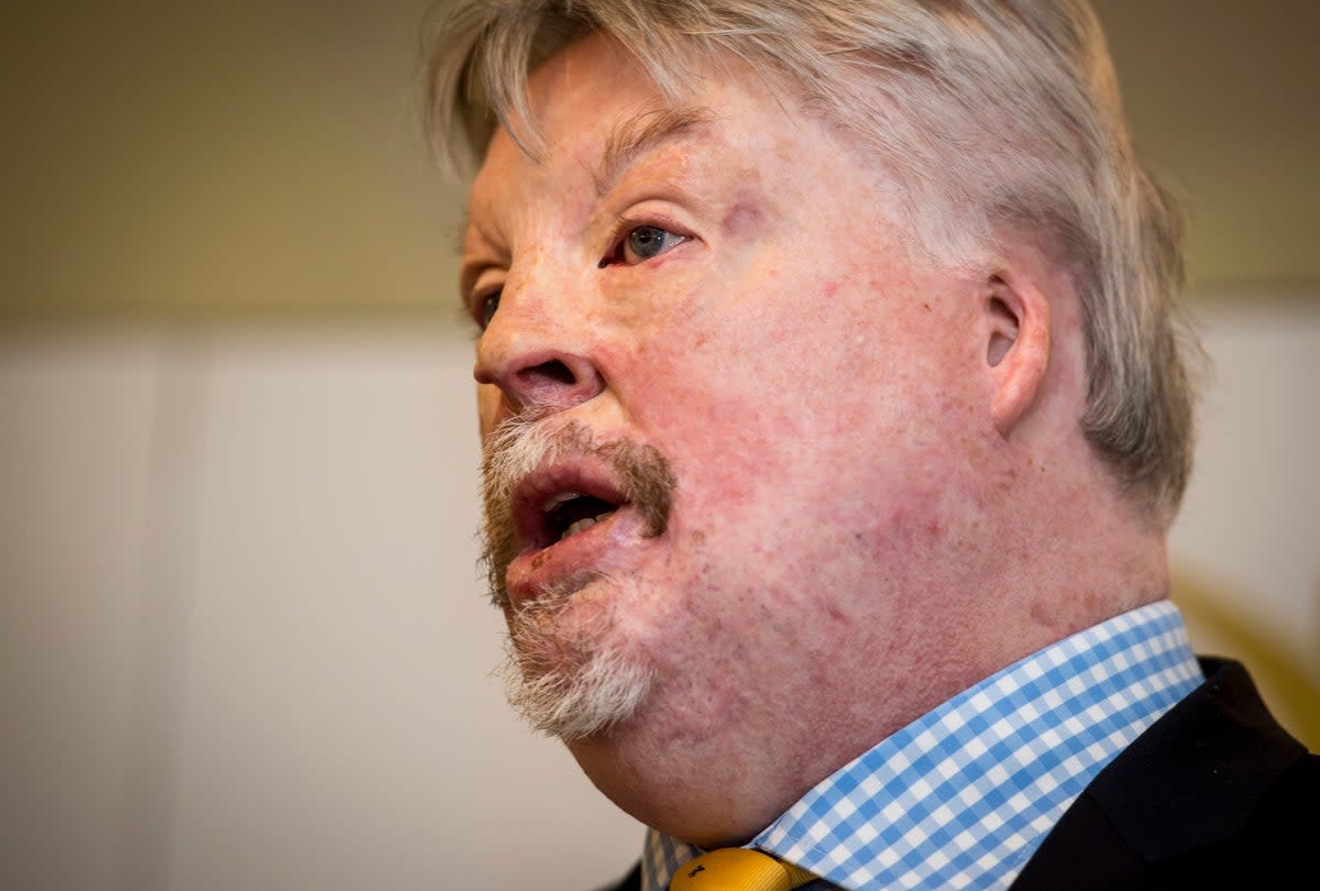 Simon Weston said the pilot had ‘shown courage, endeavour and ingenuity to get here’ (PA)