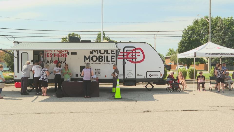 The mole mobile skin cancer screening unit on wheels will be visiting major Canadian cities with long wait times to see a dermatologist,  underserved communities, rural and indigenous regions to help speed up the time to diagnosis. 
