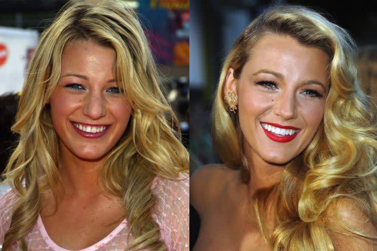 Blake Lively afinó su nariz para verse mejor pero, ¿era necesario? (Foto: Pinterest)