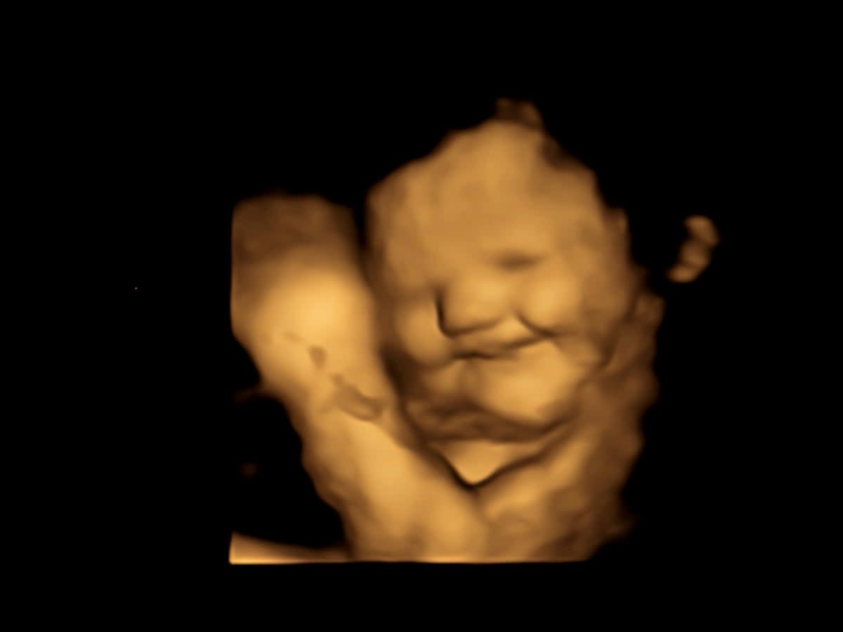A 4D ultrasound image of a baby reacting to the flavour of carrots (Durham University / SWNS)
