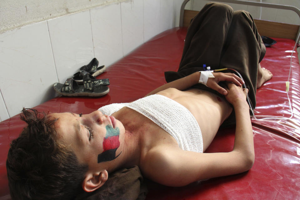 A wounded boy recovers at a hospital after an explosion in Jalalabad, east of Kabul, Afghanistan, Monday, Aug. 19, 2019. An Afghan official says at least 66 people have been wounded in a series of explosions in the eastern province of Nangarhar as the country marks Independence Day. (AP Photo/Mohammad Anwar Danishyar)